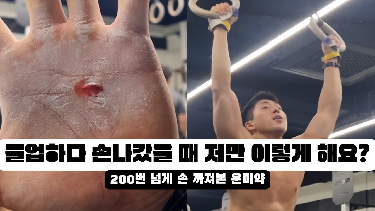 손 까졌을 때 꿀팁