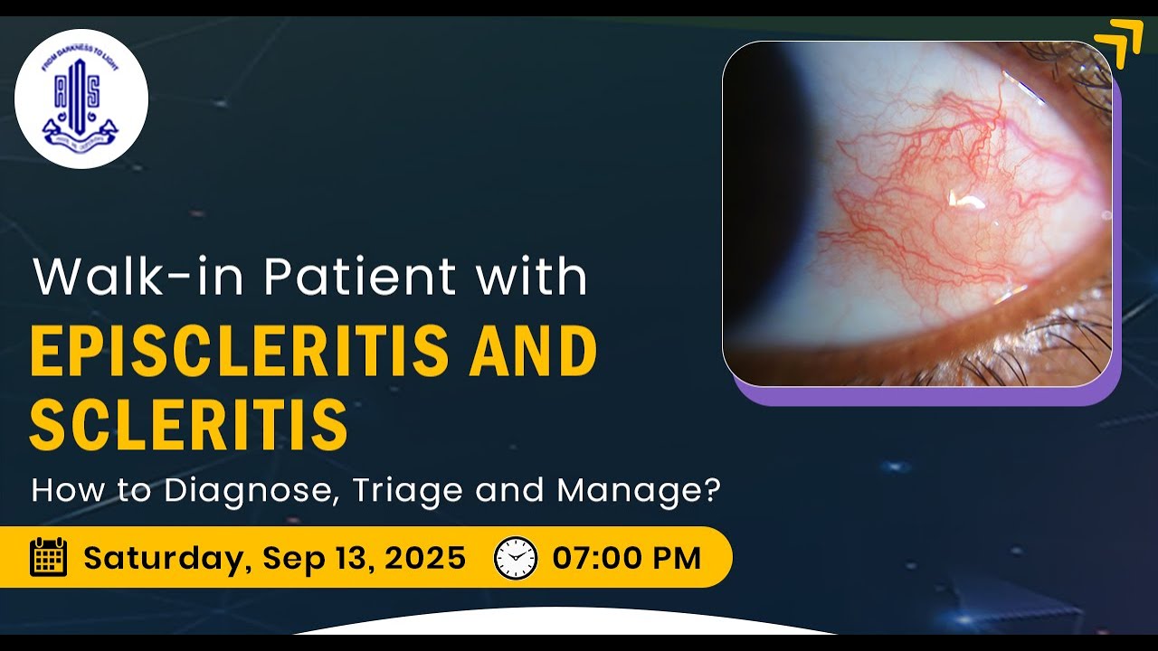 Walk-in Patient with EPISCLERITIS & SCLERITIS