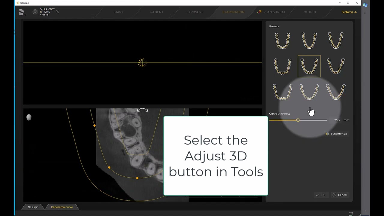 Imaging Training Session 20: Sidexis 4 - Pan Curve Editor for 5cm CBCT