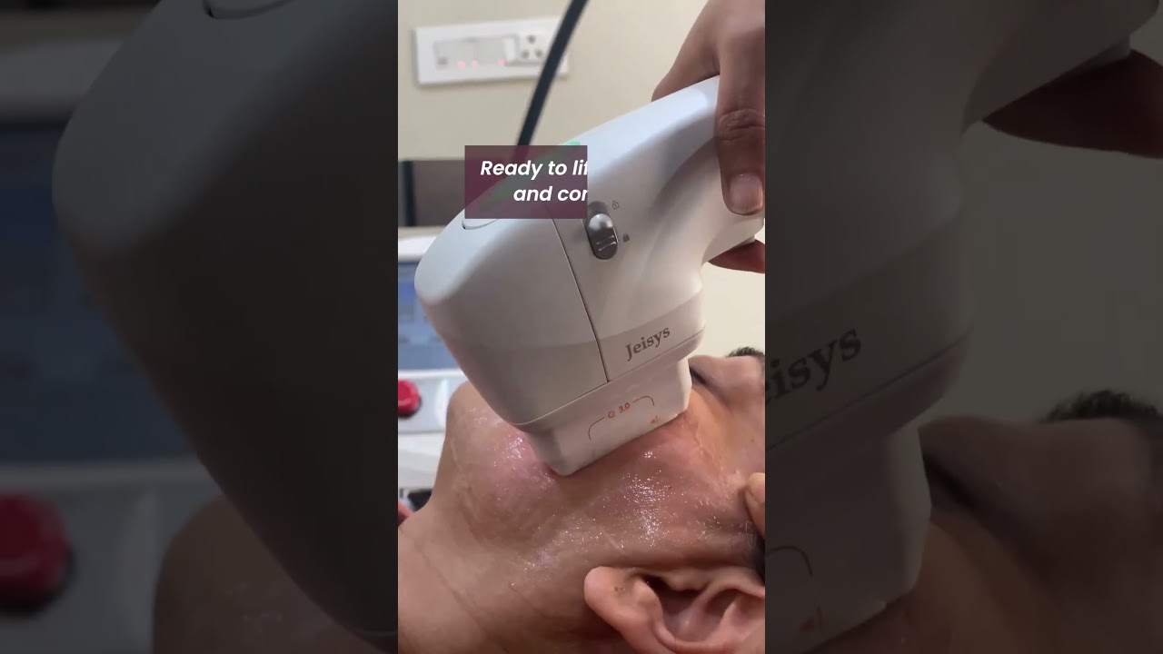 Anti Aging Solution | HIFU | Nirmal Skin and Hair Clinic