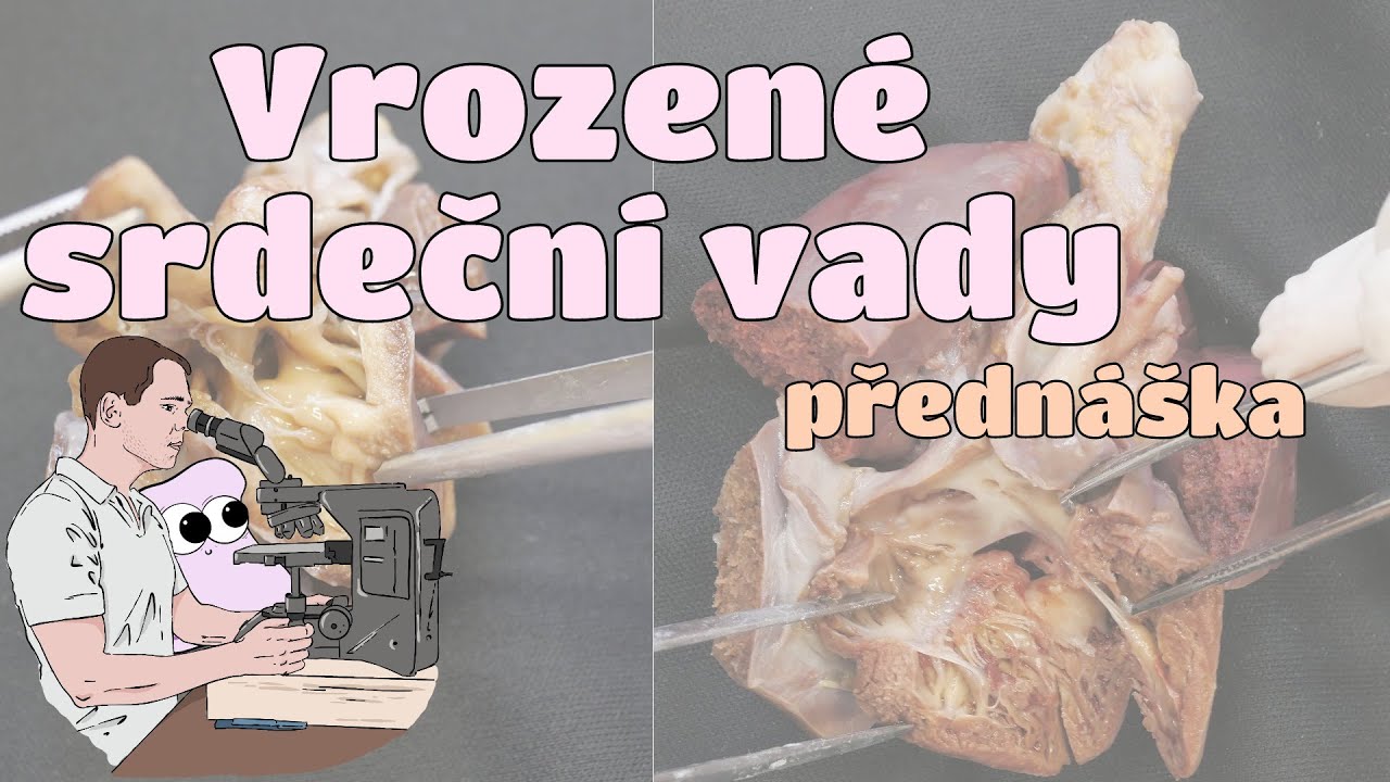 Patologie  - Vrozené srdeční vady (CZ)