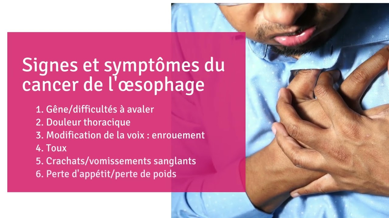 CDHF Talks du cancer de l'&oelig;sophage, partie 3: Signes et les sympt&ocirc;mes du cancer de l'&oelig;sophage