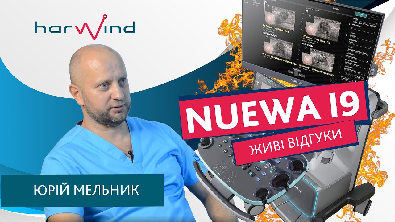 Новий УЗД Nuewa I9 від Mindray. Відеогляд.