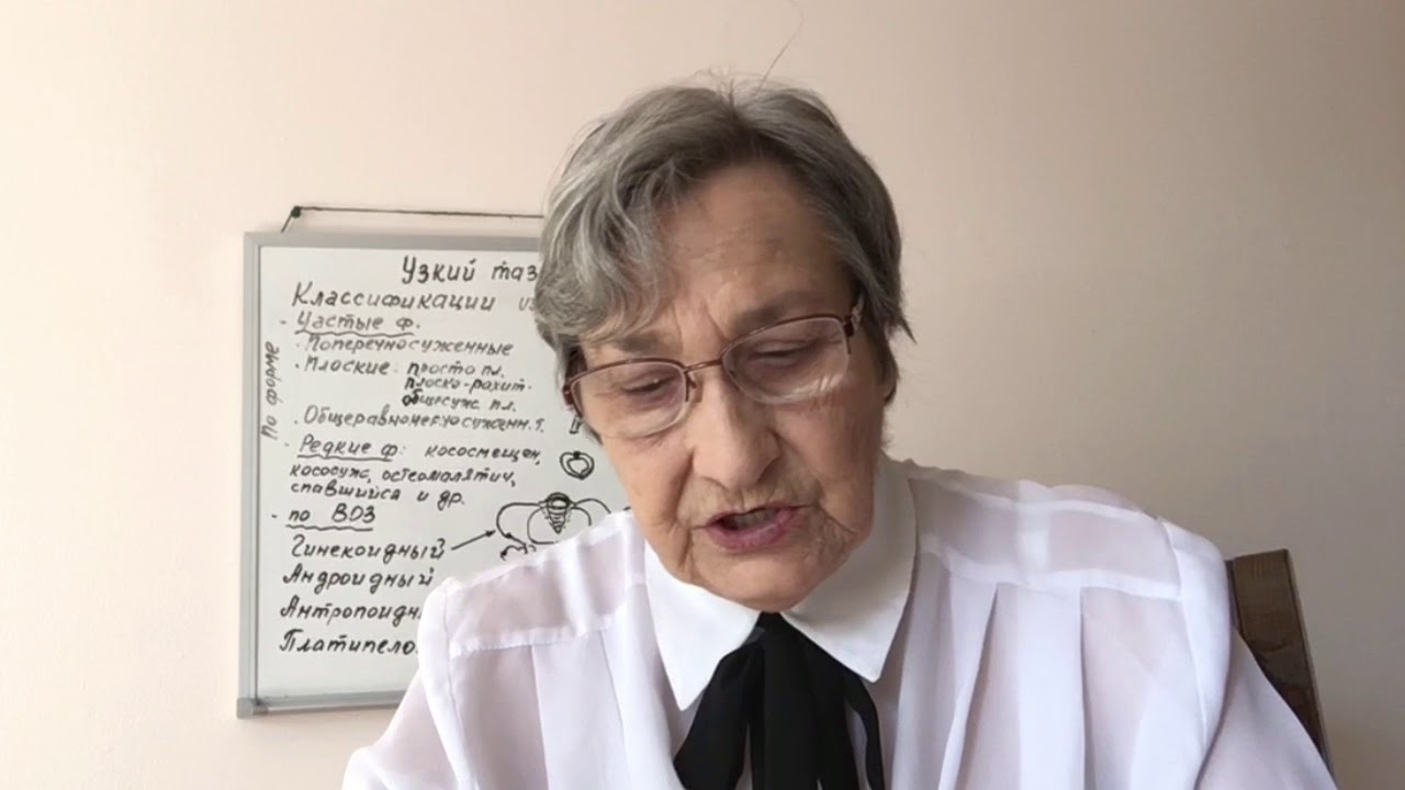 Узкий таз в акушерстве (61)