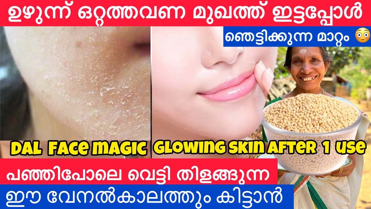 ഉഴുന്ന് ഒറ്റത്തവണ മുഖത്ത് ഇട്ടതാ മുഖം വെട്ടി തിളങ്ങി പഞ്ഞിപോലെ മുഖമായി 😱ഞെട്ടിക്കുന്ന മാറ്റം