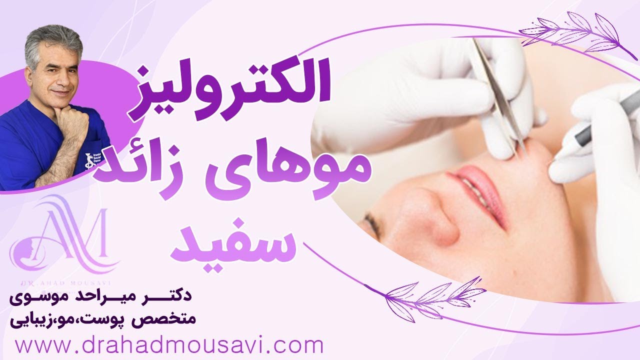 الکترولیز موهای زائد و سفید با نتیجه دائمی در بهترین کلینیک لیزر تهران