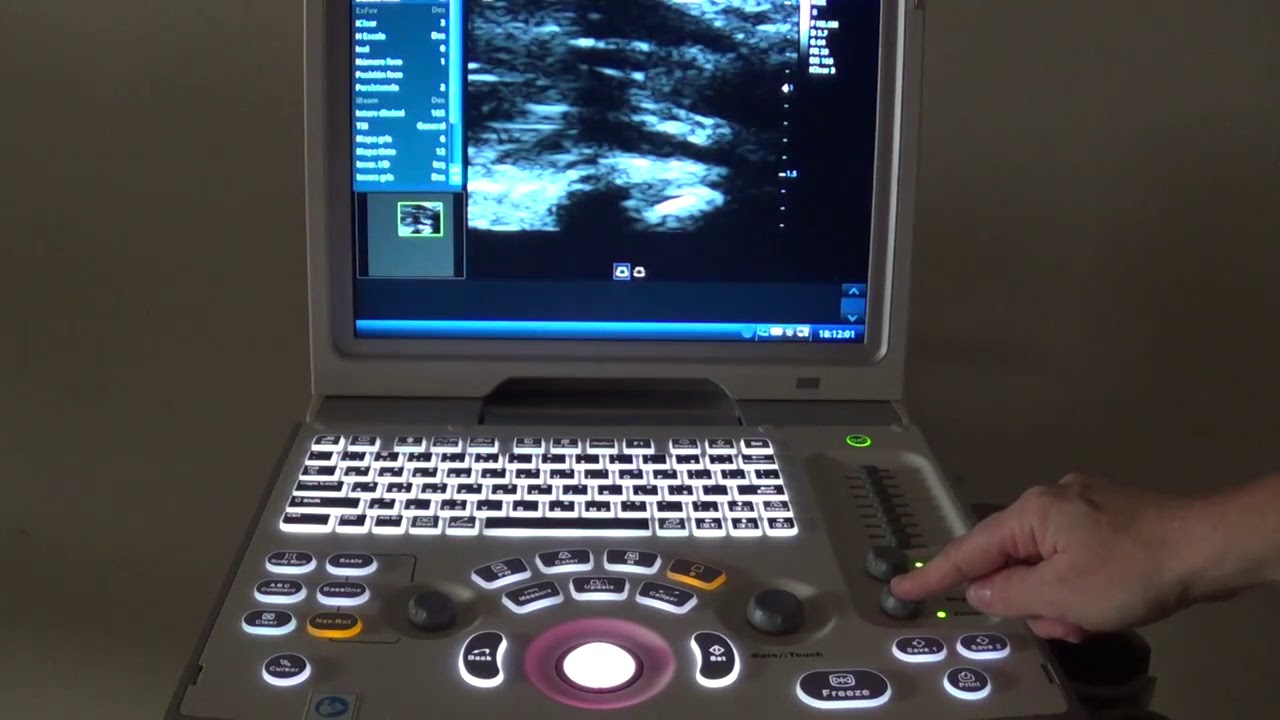 Realizar Zoom en Ecógrafo Mindray Z6