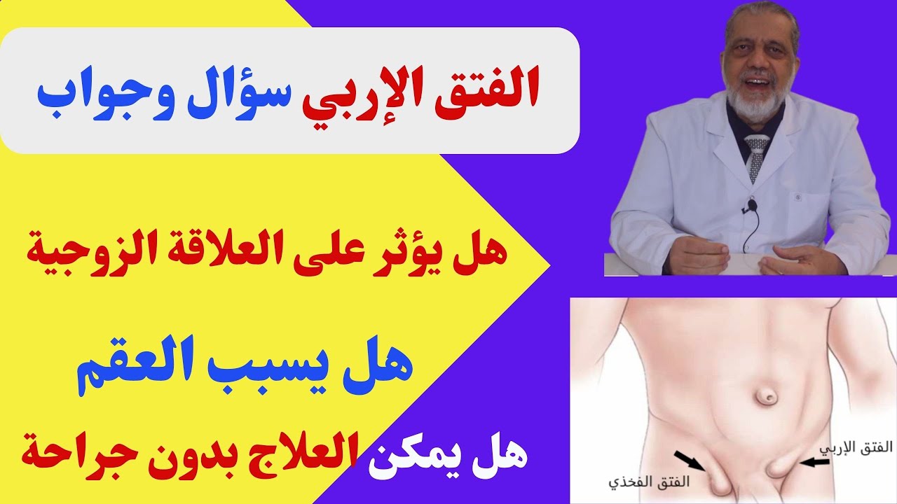 الفتق الإربي، سؤال وجواب،هل يؤثر على الإنجاب، هل العملية جراحة أم ليزر أم منظار د/علي بطيخ يجيب