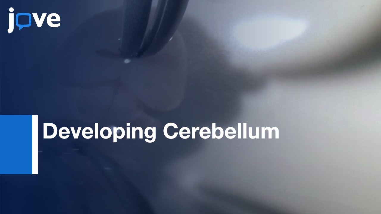 Distinct Cell Populations Microdissection from Developing Cerebellum | Protocol Preview