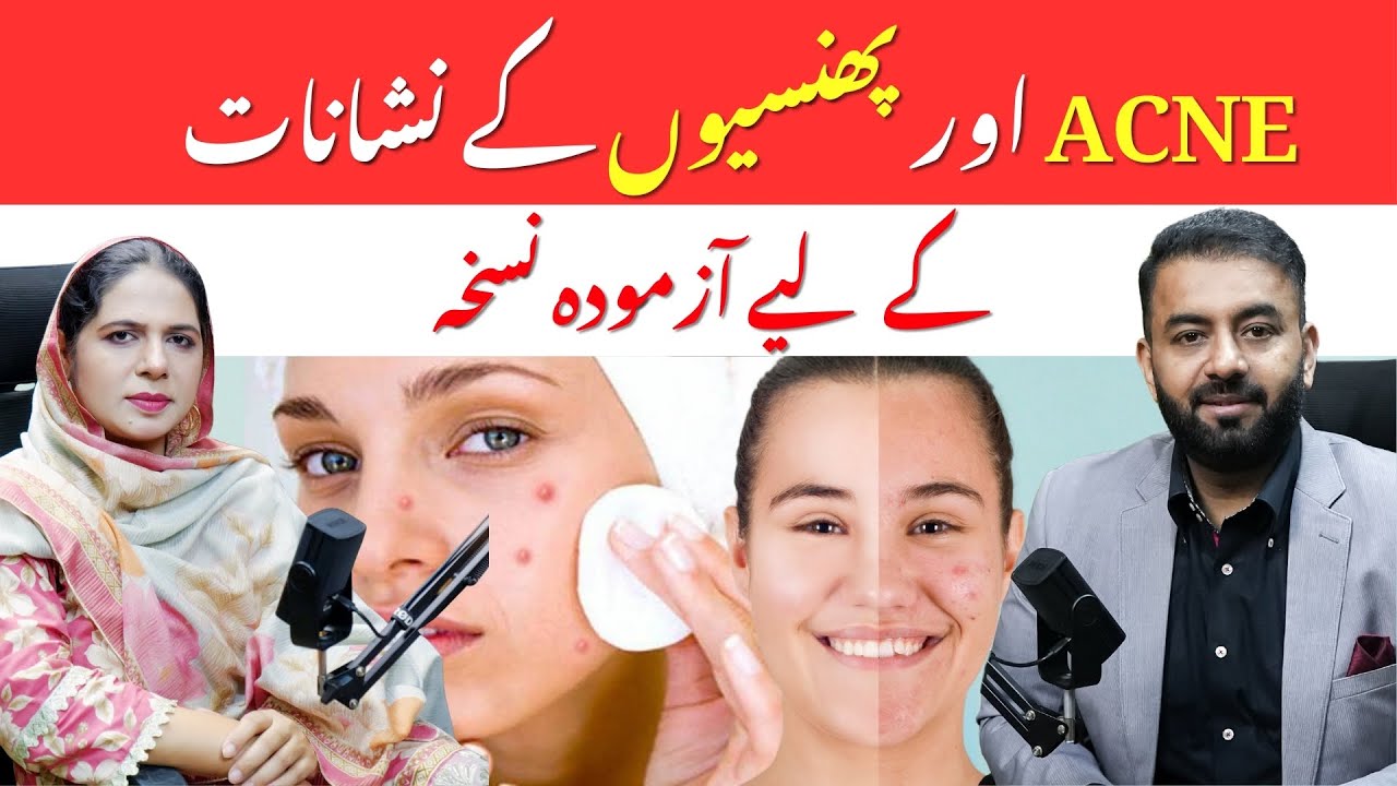 Acne & Pimples Marks Ka Asaan Natural Ilaj | Naima Apa | Think Digital Podcast