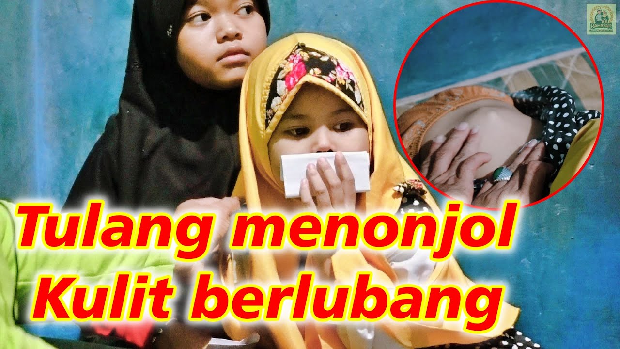 Anak Piatu dengan Penyakit Langka - Part 1