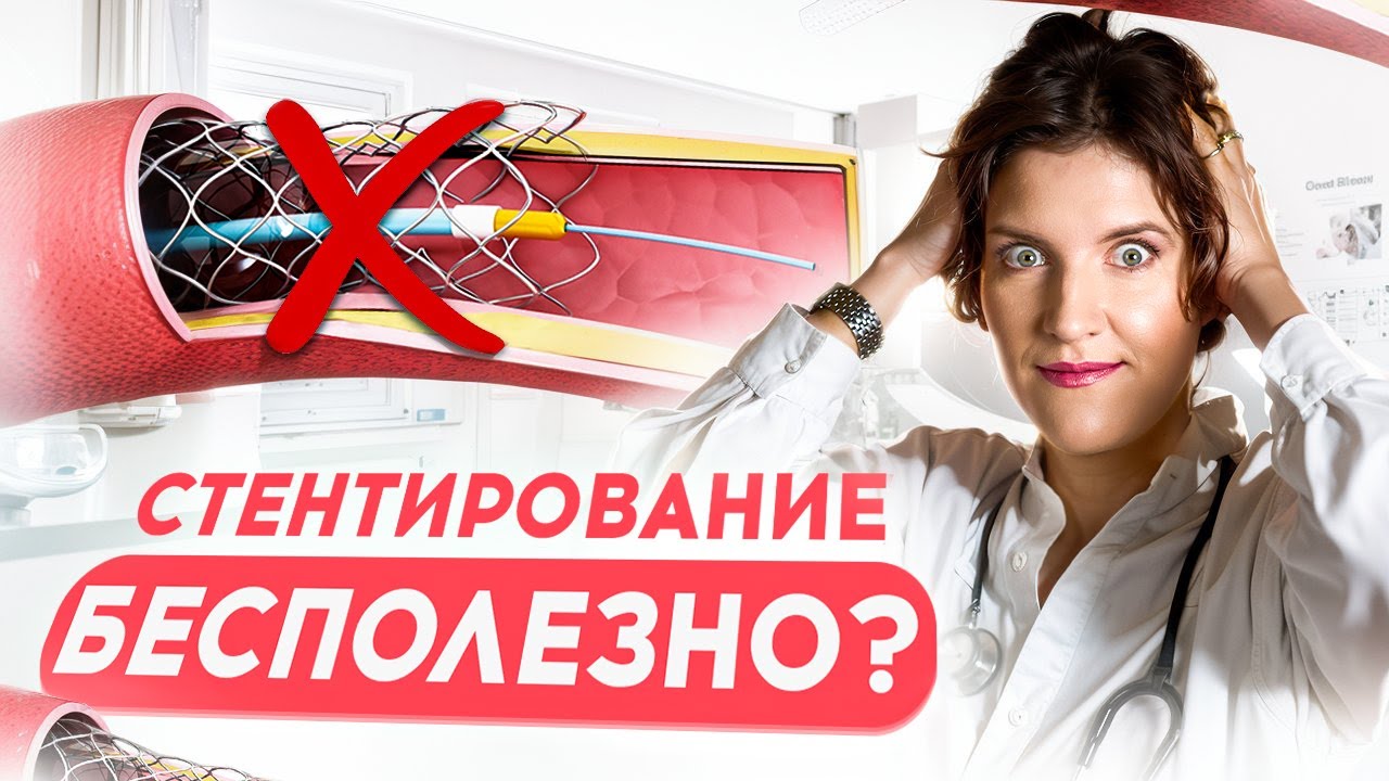 Стент в сердце: Когда ОПЕРАЦИЯ НЕ НУЖНА? Вся правда о стентировании артерий.