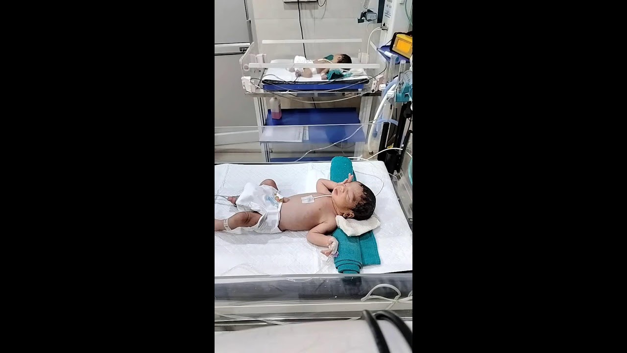 Icu and. Nicu care and treatment in NICU picu NICU