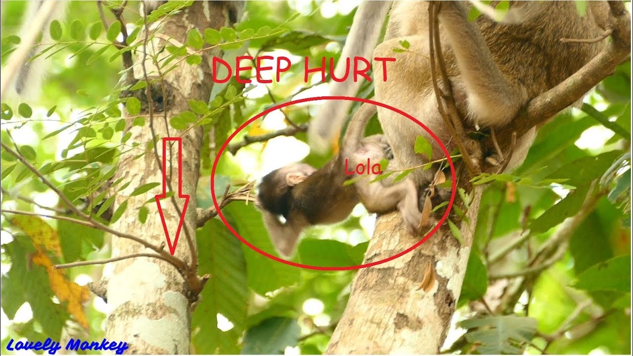 MillionHurt! Baby Lola Cries Seizure & Hurt From Tara D0_Bad_Crazy Drag Lola  0n The Tree. Poor 0ne