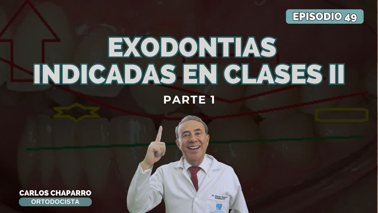 EXODONCIAS INDICADAS EN CLASES II - PARTE 1 - EPISODIO 49