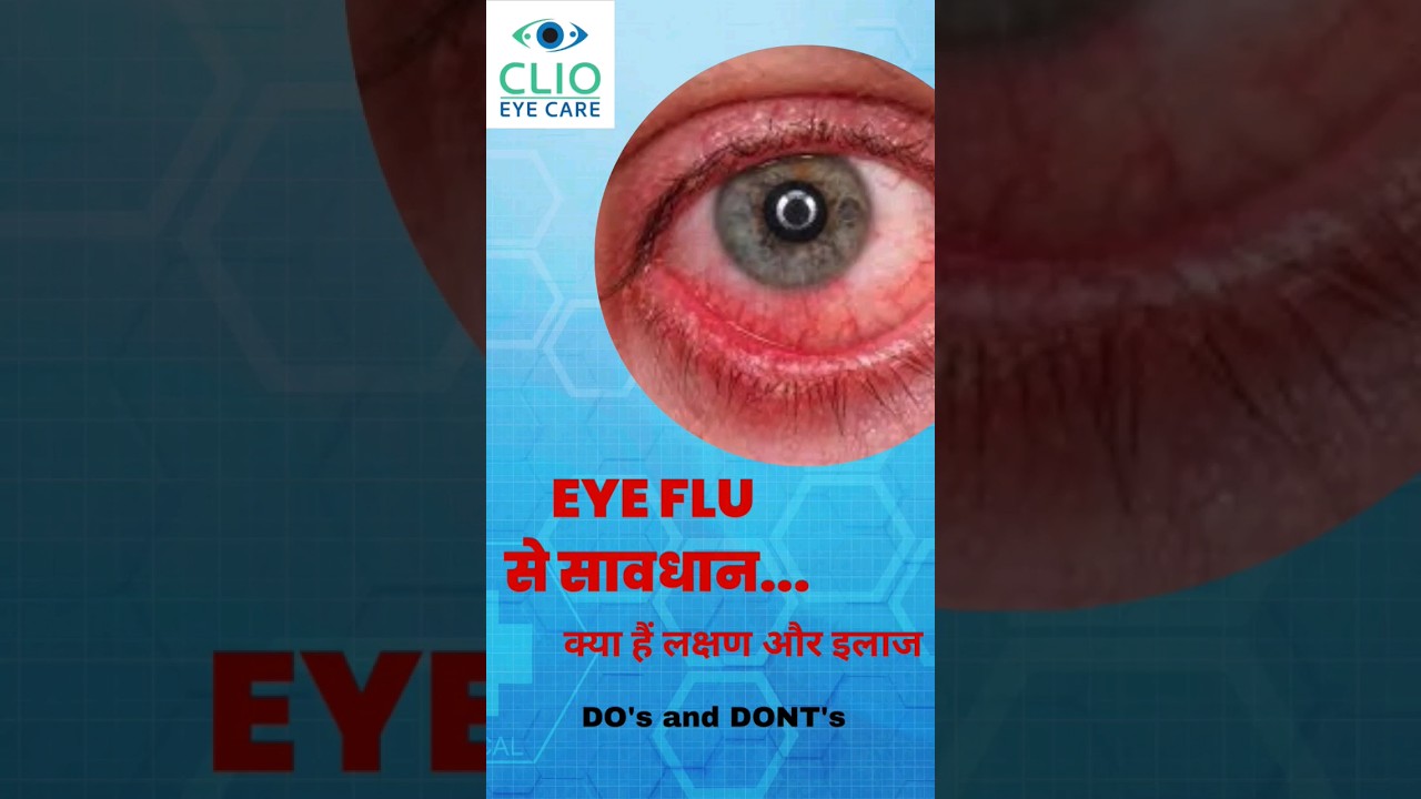 Eye Flu this monsoon  | know symptoms and prevention| Clio Eye Care
