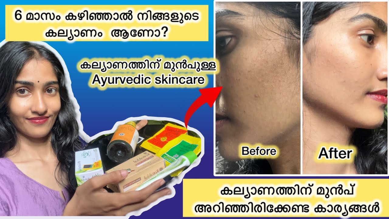 Before Marriage😱അറിഞ്ഞെരിക്കണ്ട Skincare Routine | For Skin Brightening & Glow ✨#skinbrightening 