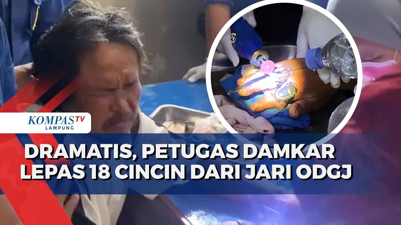 Dramatis, Petugas Damkar Lepas 18 Cincin dari Jari ODGJ