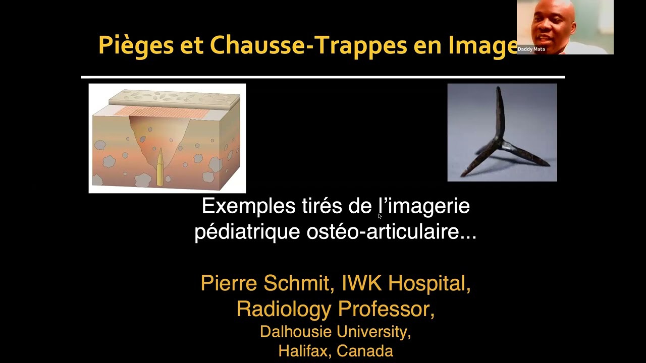 Pièges et Chausse-trappes en Radiologie Pédiatrique ostéoarticulaire