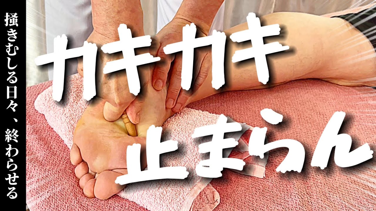 【危険信号】燃えるかゆみ《皮膚炎》放置すると全身が毒まみれ！？【ゴリゴリ足ツボ 4K】
