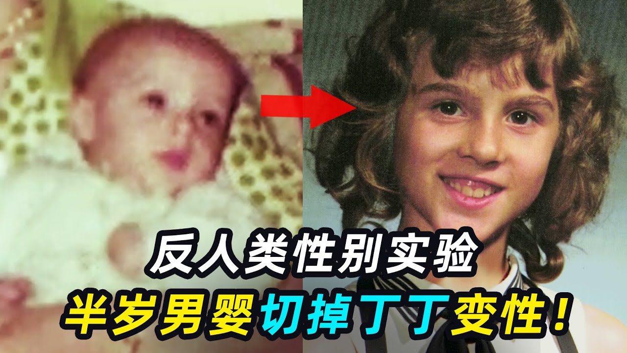 美国最反人性实验，男婴被迫切掉丁丁，当女孩抚养！