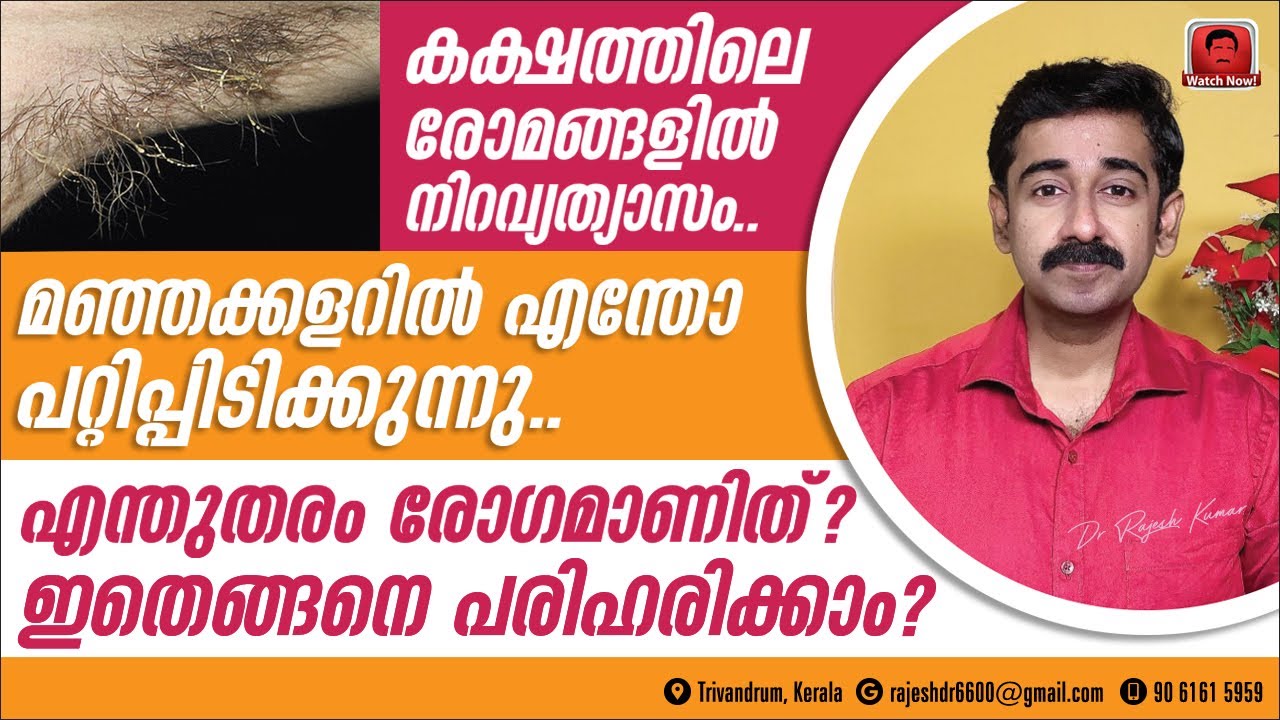 കക്ഷത്തിലെ രോമങ്ങളിൽ മഞ്ഞക്കളറിൽ എന്തോ പറ്റിപ്പിടിക്കുന്നു. .എന്തുതരം രോഗമാണിത് ? മാറാൻ ഒറ്റമൂലികൾ
