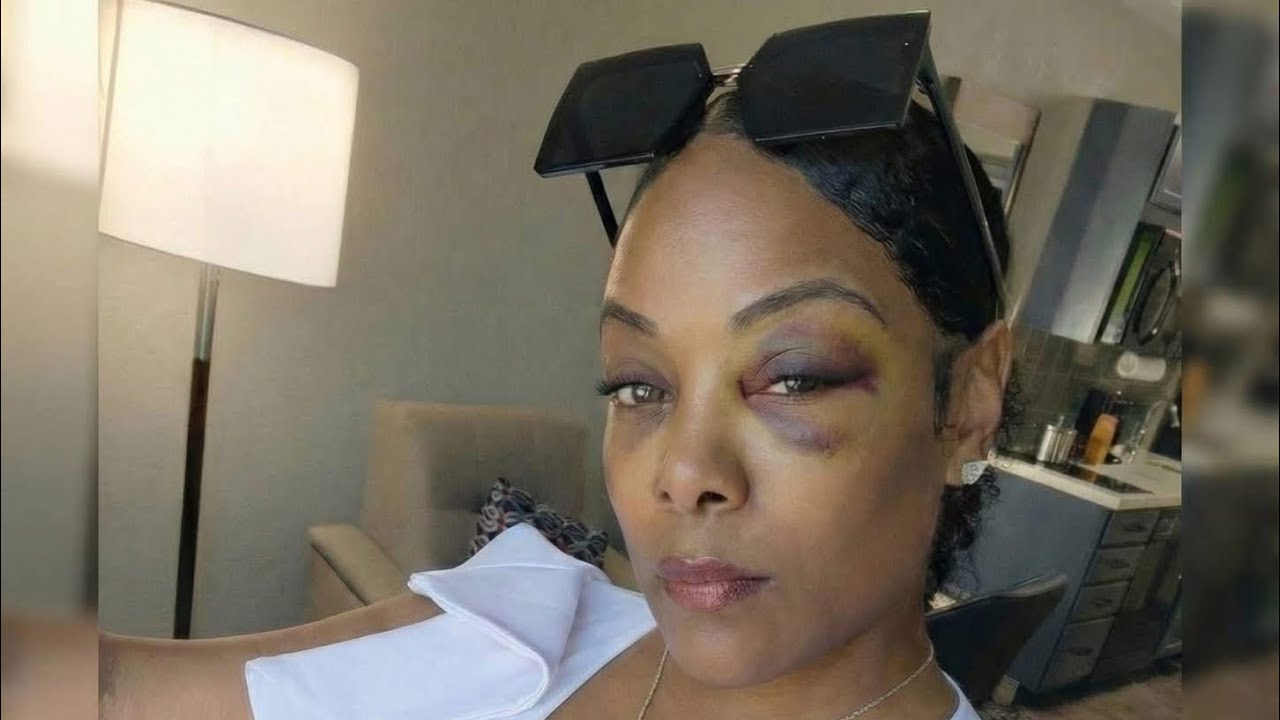 California Woman Got Beat Up In Jamaican Baby Mama Drama😱🤔/ Danchall Artiste squash set for Deprt😏