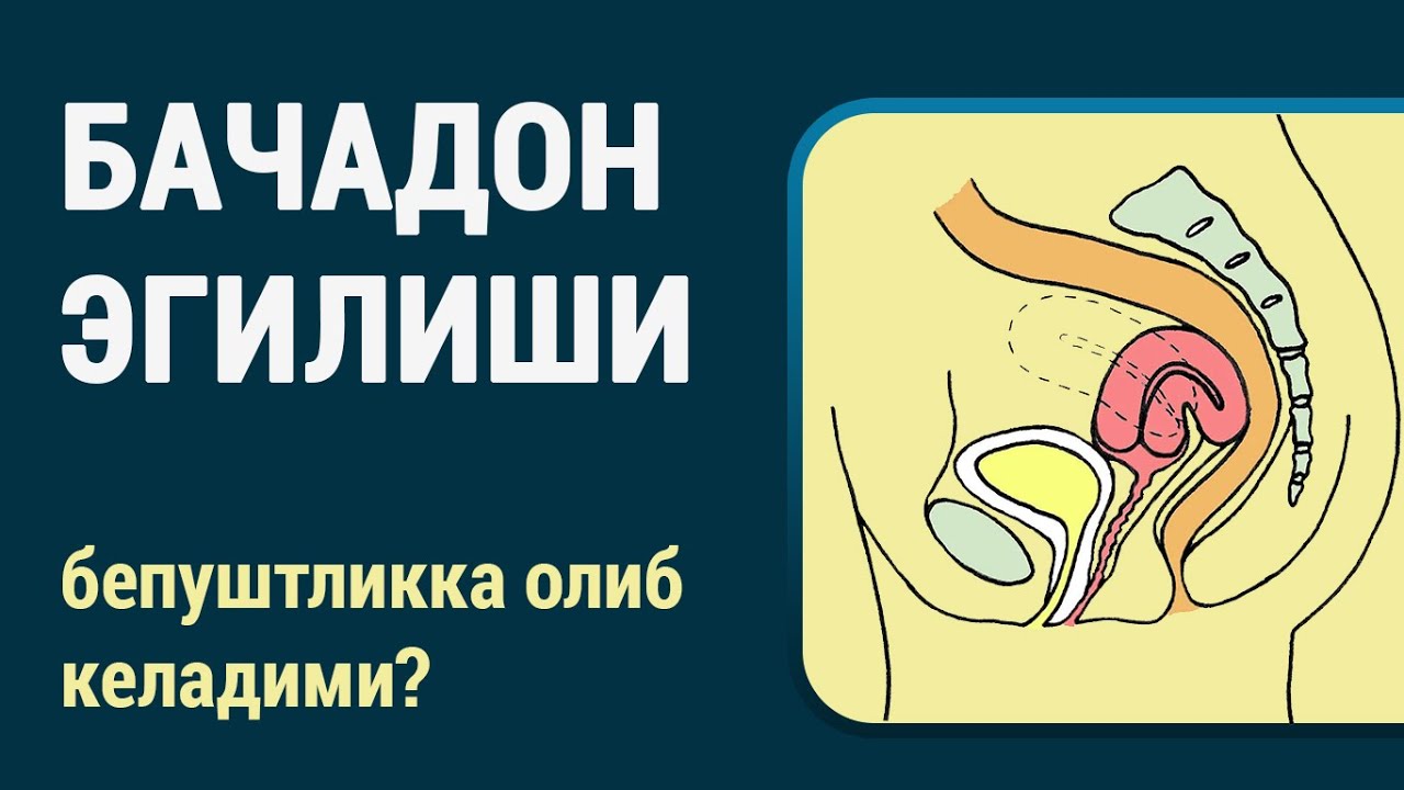 Бачадон эгилиши | Загиб матки