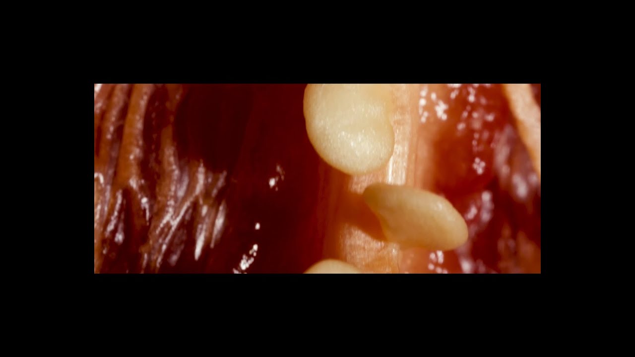 Dusky - Skin Deep (Official Video)