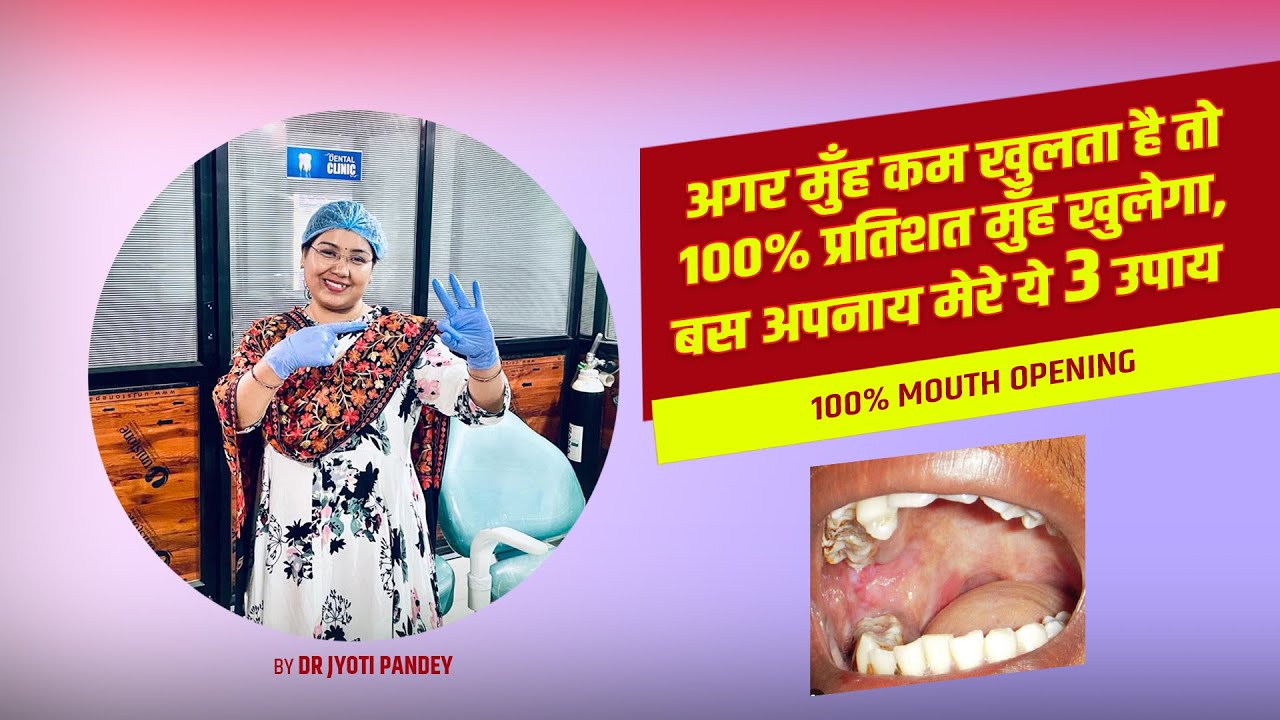 अगर मुँह कम खुलता है तो 💯प्रतिशत मुँह खुलेगा ,बस अपनाय मेरे ये 3 उपाय ||