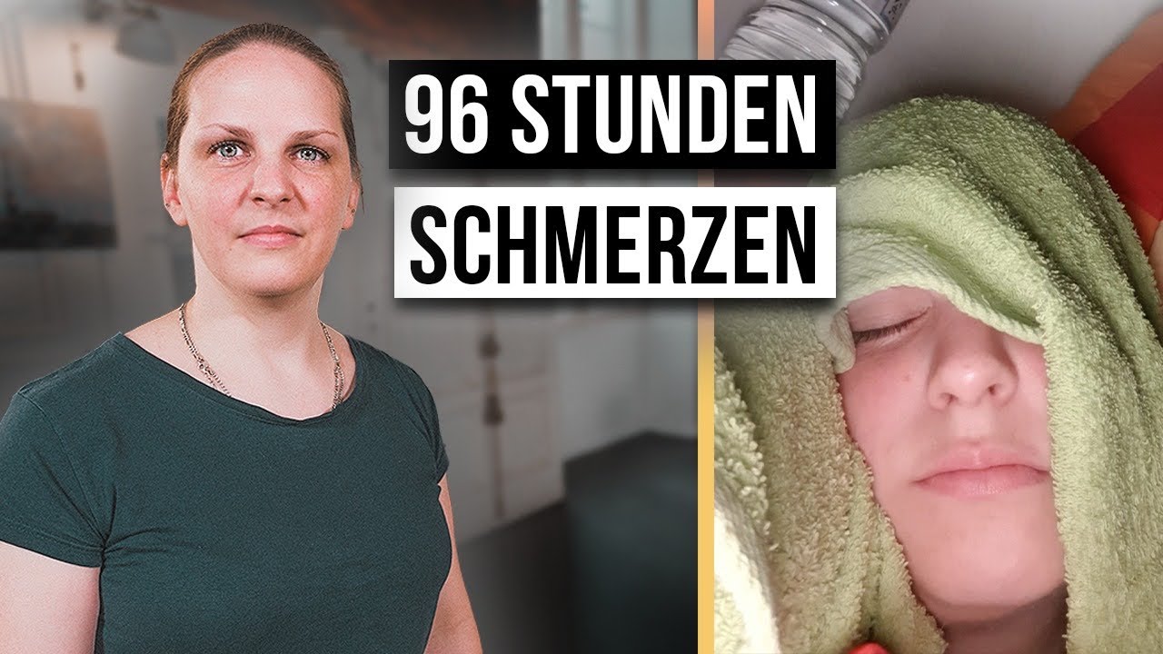 Wie ist das MIGRÄNE ZU HABEN?