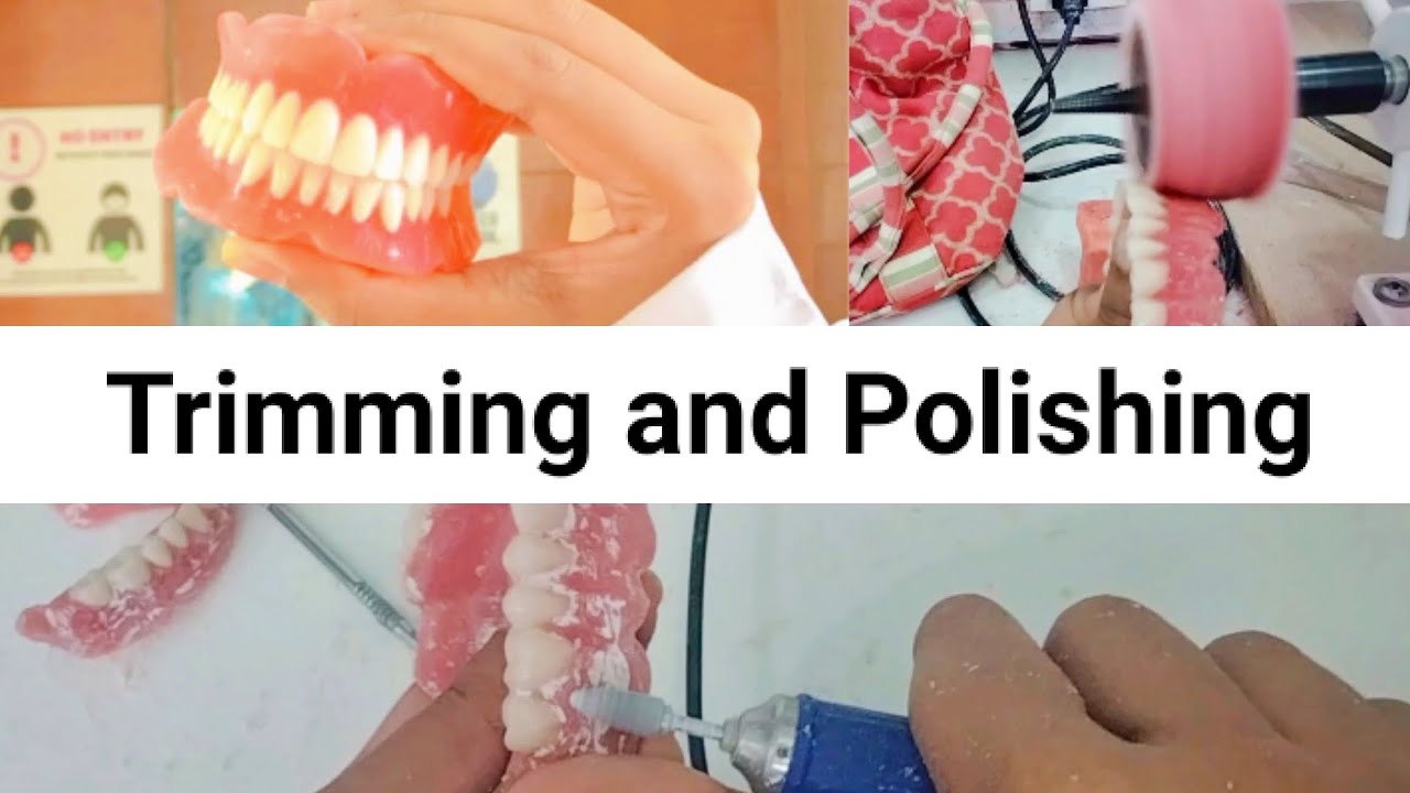 Step#17 Trimming and Polishing #complete_denture
