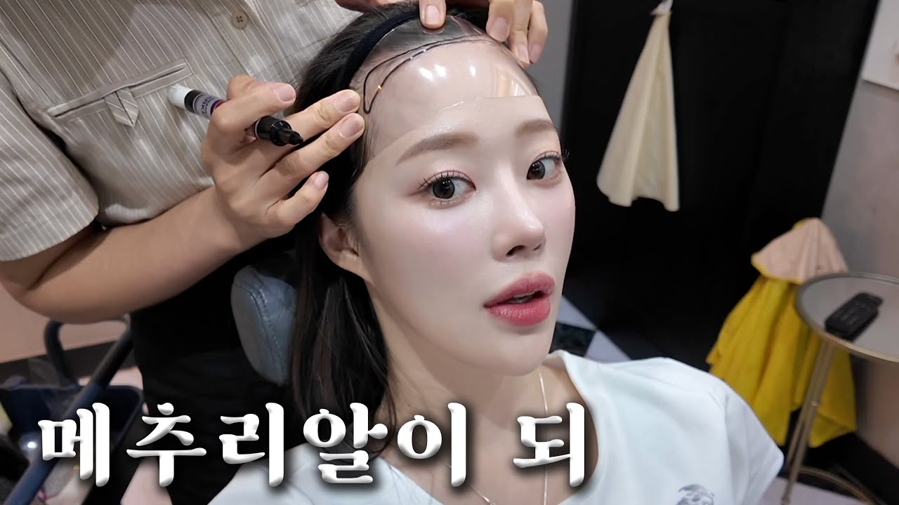 얼굴 작아 보이는 헤어라인 맞춤가발🦁 (가격/후기/착용감/단점•장점/M자이마)ㅣMINCARONG