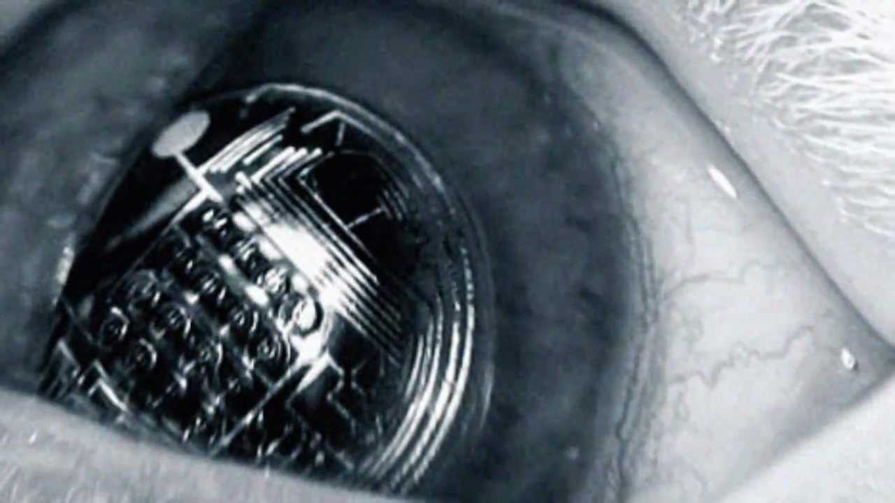 COMPUTERIZED CONTACT LENSES