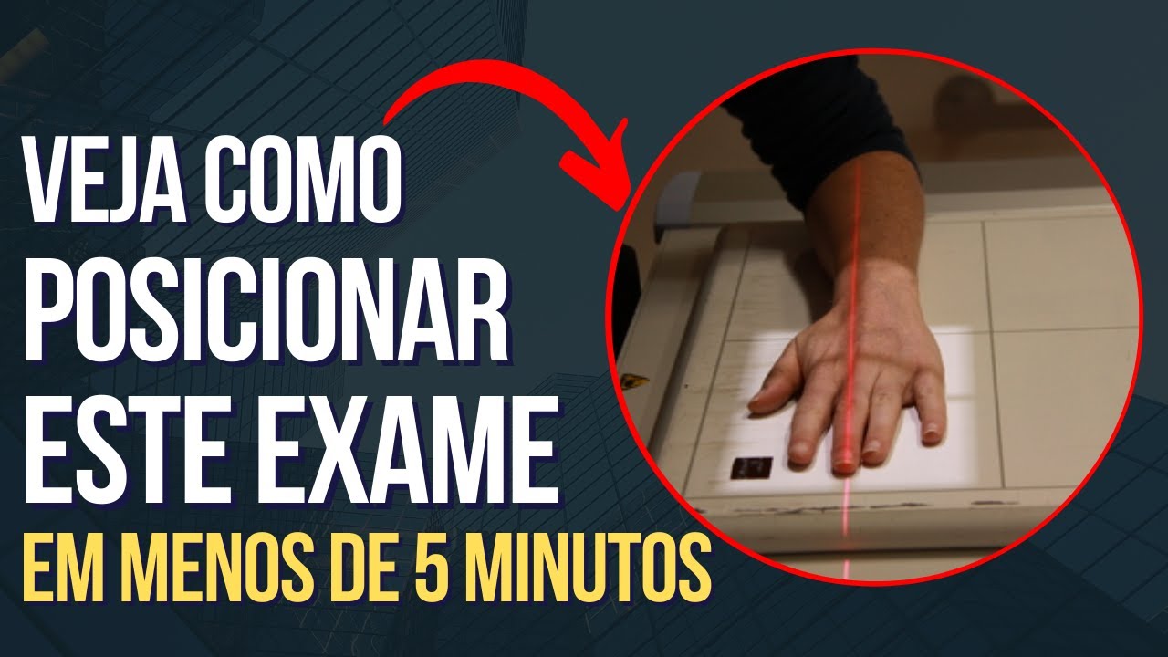 Posicionamento radiológico da mão PA