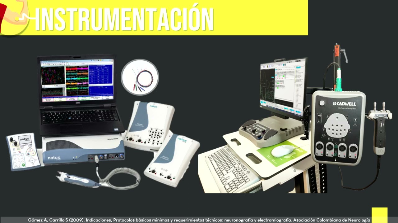 ELECTROMIOGRAFIA.