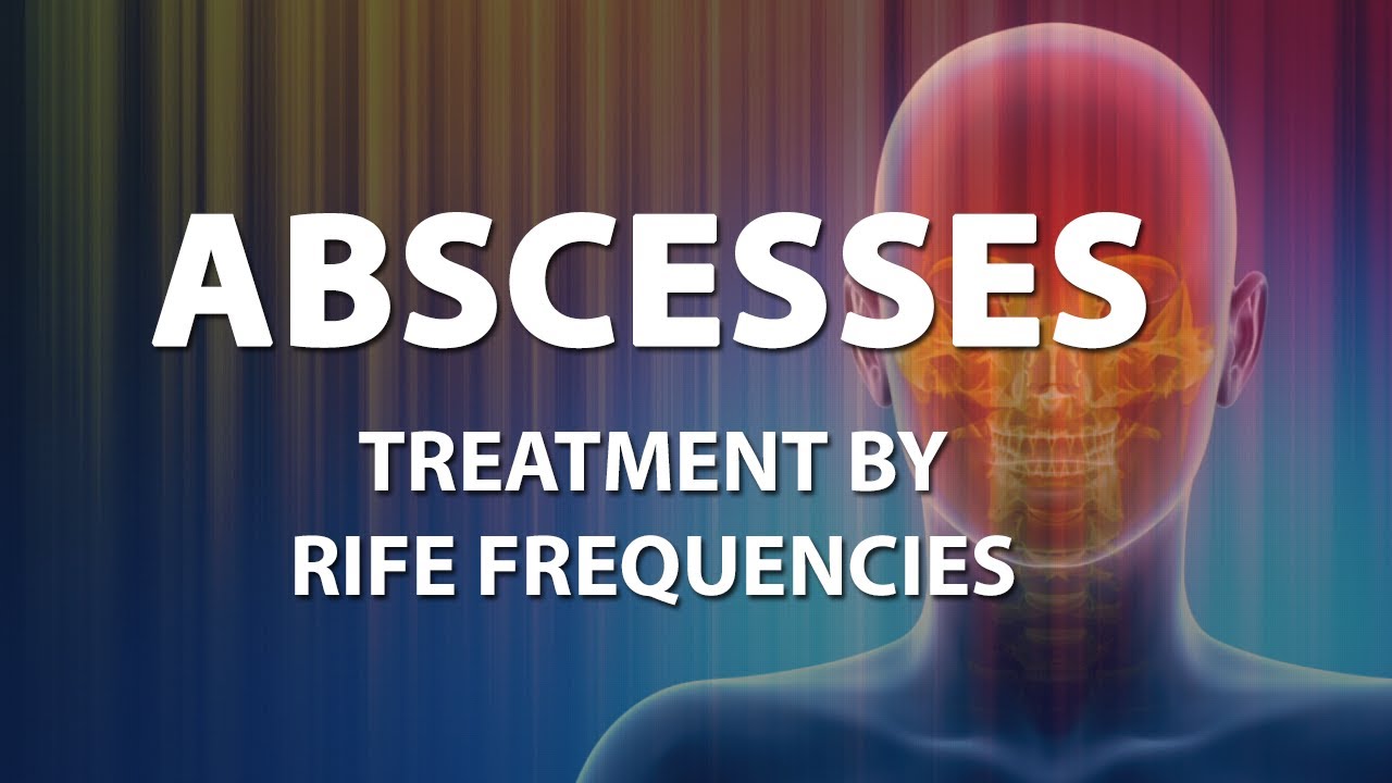 Abscesses - RIFE Frequencies Treatment - Energy & Quantum Medicine with Bioresonance