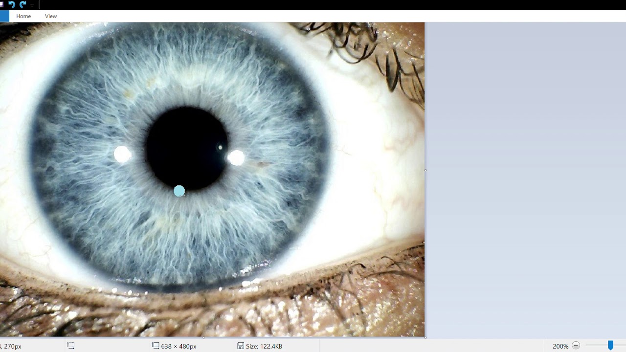 Iridology Lesson - Iris Reading #1