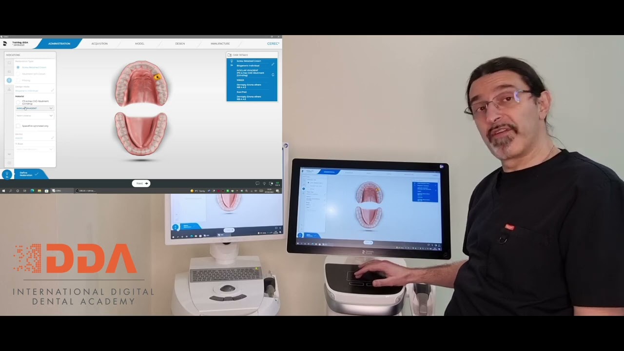 How to Set Up & Configure an IMPLANT Ti-Base case in CEREC with Tips - IDDA MiniBytes Tutorials