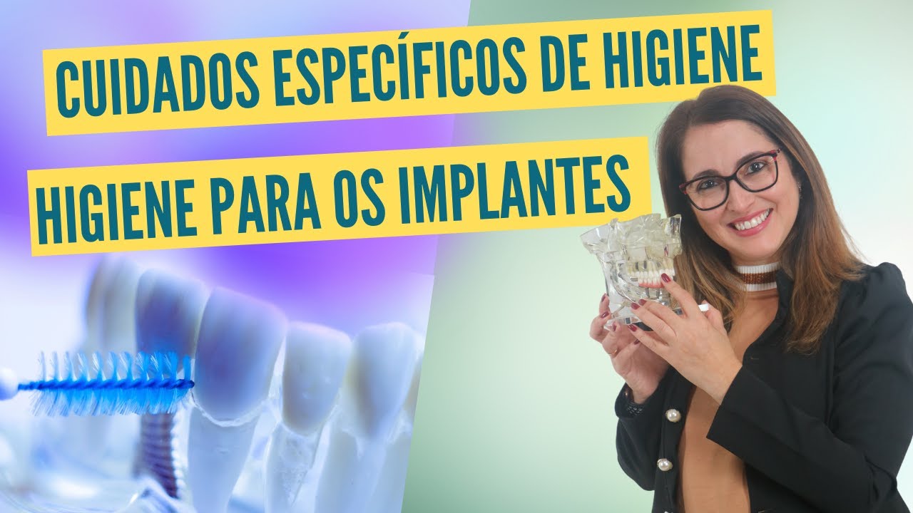 Cuidados específicos para higiene dos implantes | Adornare Odontologia Estética em Santos