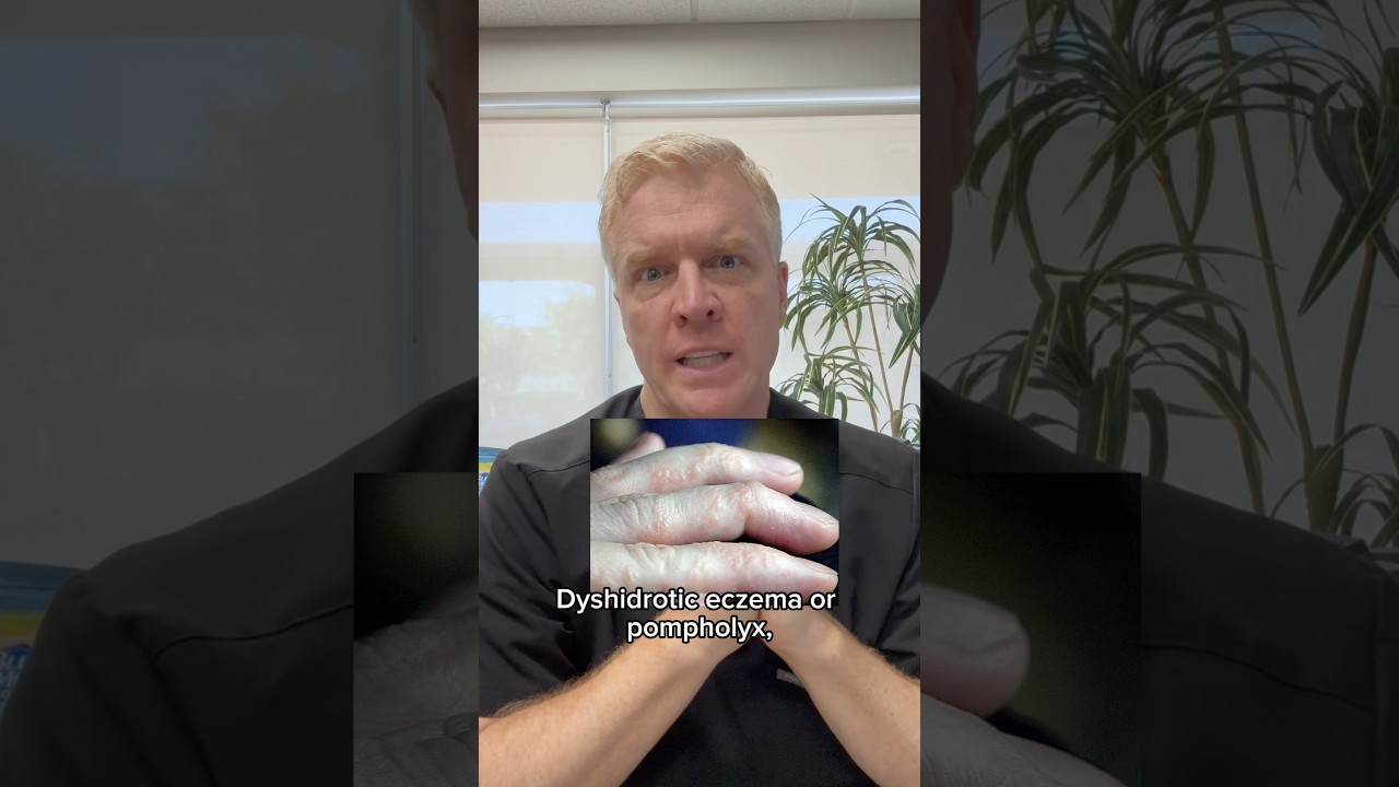 Dyshidrotic Eczema