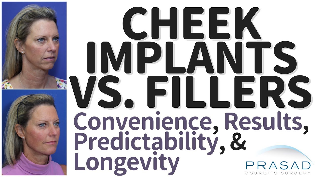 Cheek Implants Vs. Fillers - Factors of Patient Convenience, Results, Predictability, and Longevity