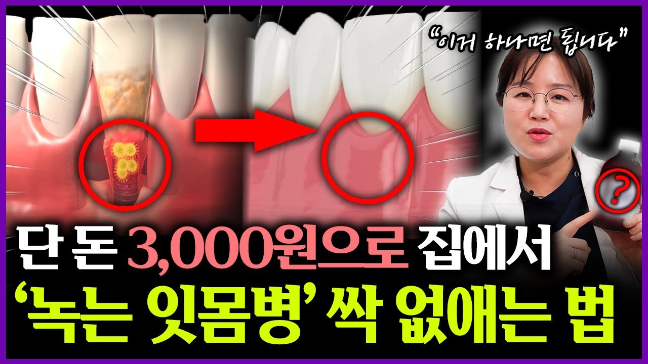 잇몸병이 있다면 집에서 ‘이것’만 하시면 됩니다! 녹는 잇몸병 전부 사라집니다