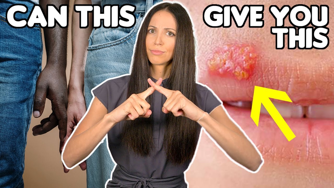 Can You Get Genital Herpes From Cold Sores?