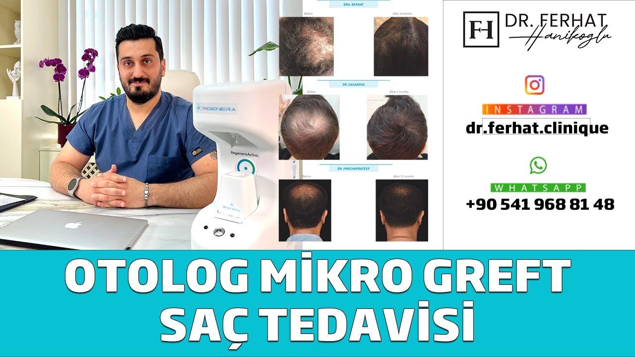Otolog Mikro Greft Saç Tedavisi ( Regenera Activa )
