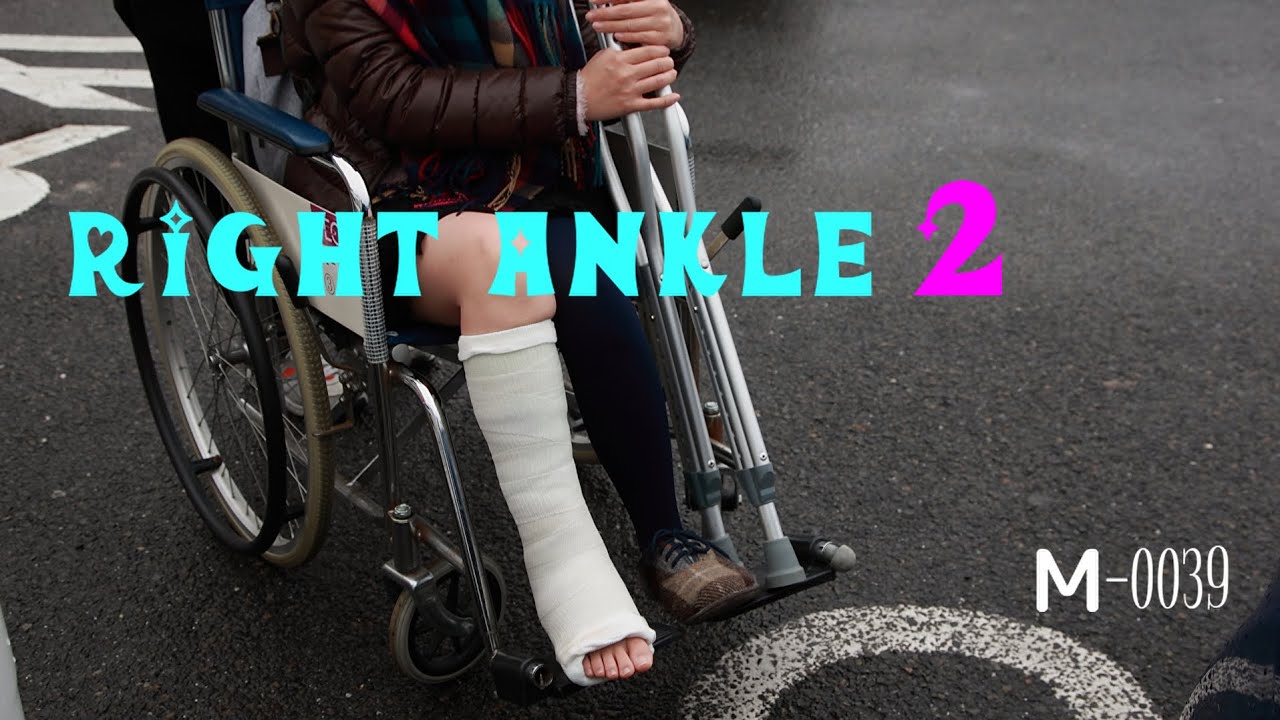 M-0039 Right ankle2　ゆかりのギプス　SLC