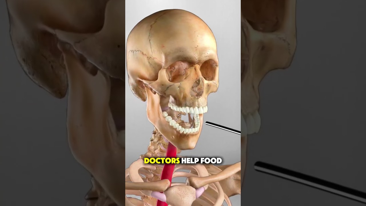How Doctors Fix Swallowing Problems 🫁🍽️! #facts #knowledge  #interestingfacts #interesting #shorts