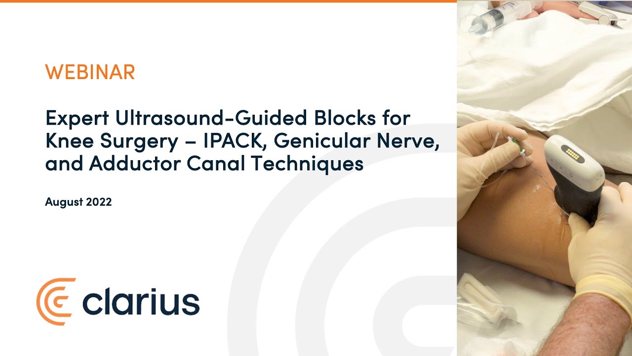 Expert Ultrasound-Guided Blocks for Knee Surgery–IPACK, Genicular Nerve & Adductor Canal Techniques