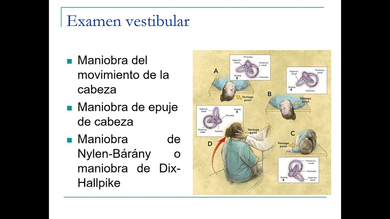 Semiología del VIII nervio craneal