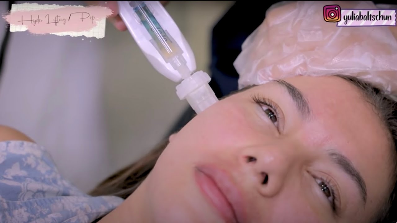 PERAWATAN ACNE SCARS || BANOBAGI KLINIK / BEAUTIQUE KOREA